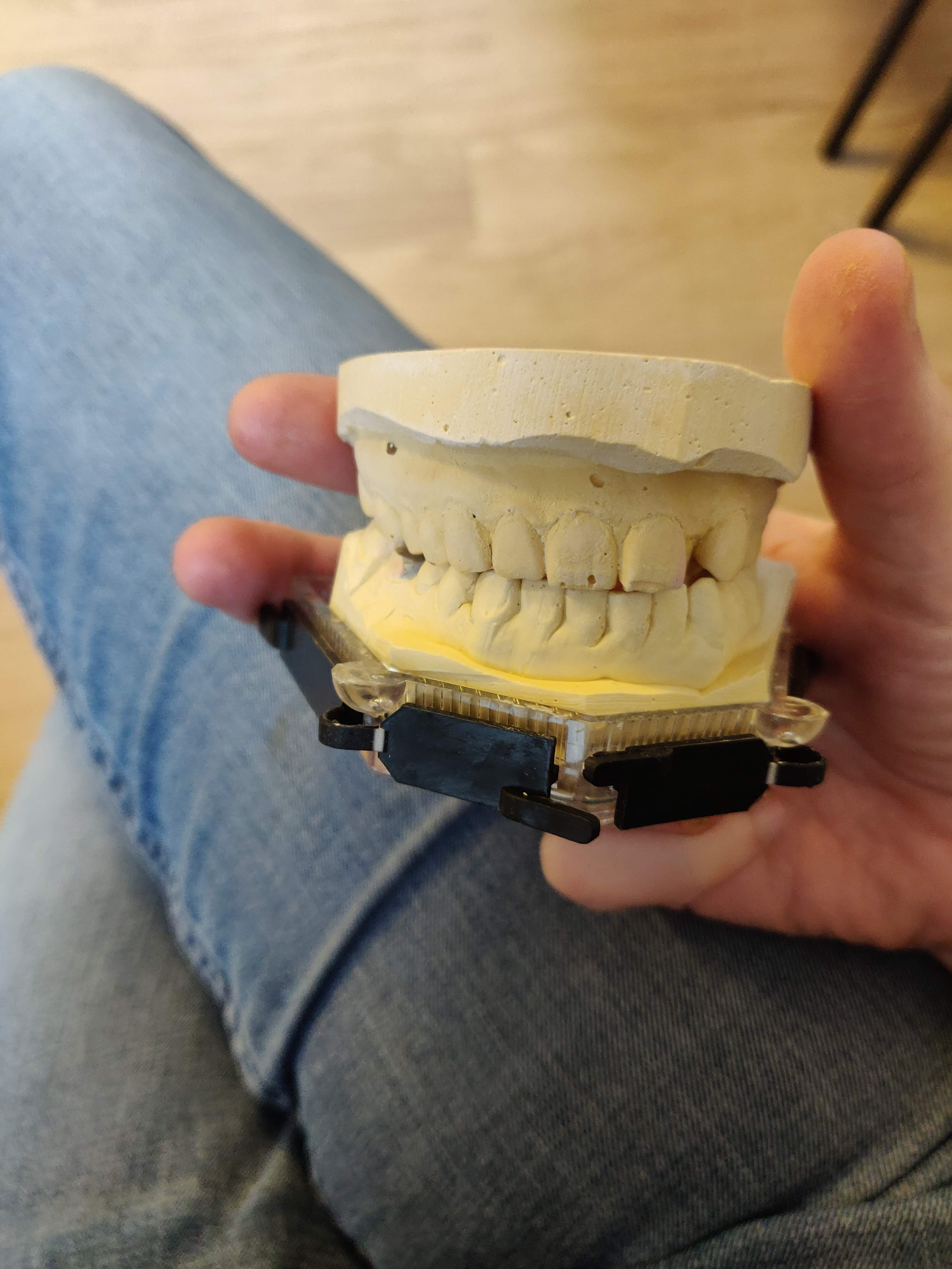 teeth_model